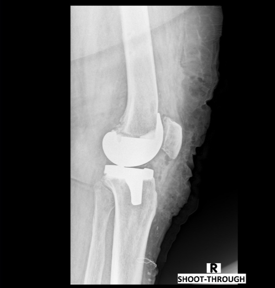 Robotic Knee X-ray